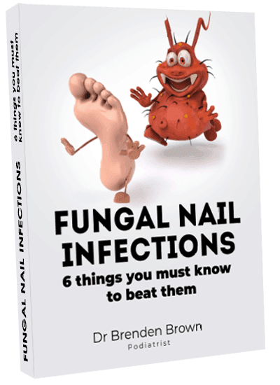 Fungal Nail Infection Report