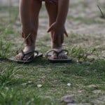 10yr old girl with feet turning in