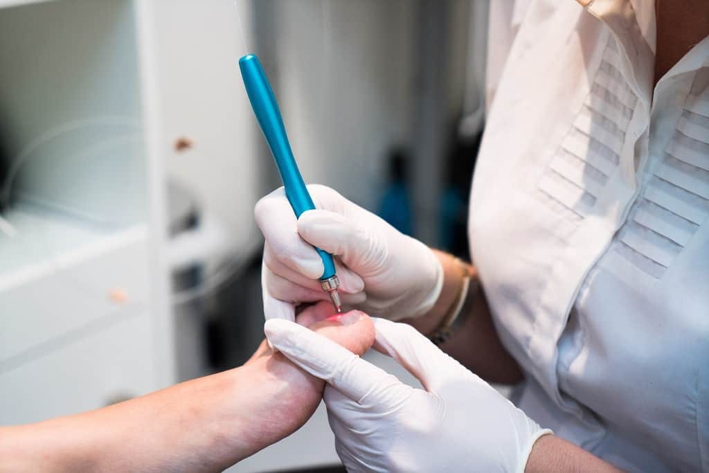 Fungal Nail Treatment