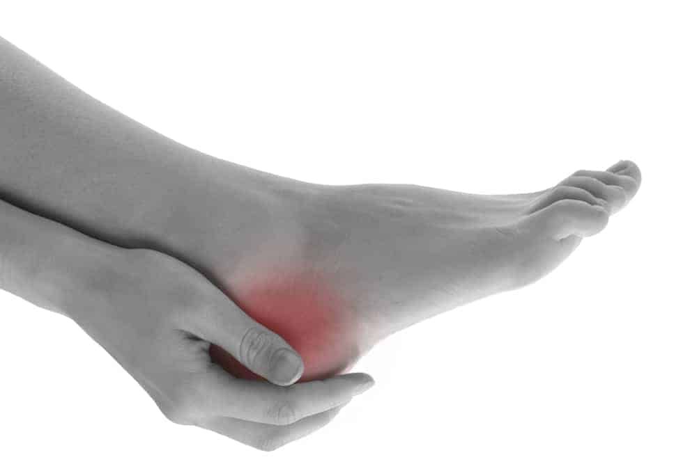 4 hacks for Achilles heel pain - 1