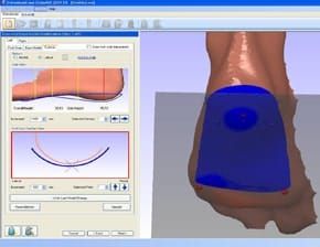 Do Orthotics Fix Heel Pain?