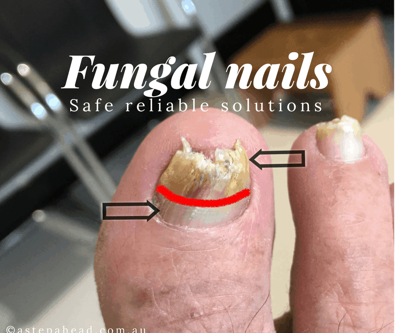 Don’t get laser therapy until you’ve read this report (1 minute read time!)