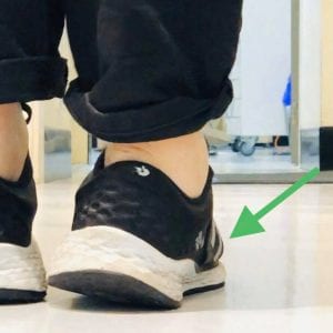 How Long Do Your Shoes Last? - Malformed Upper