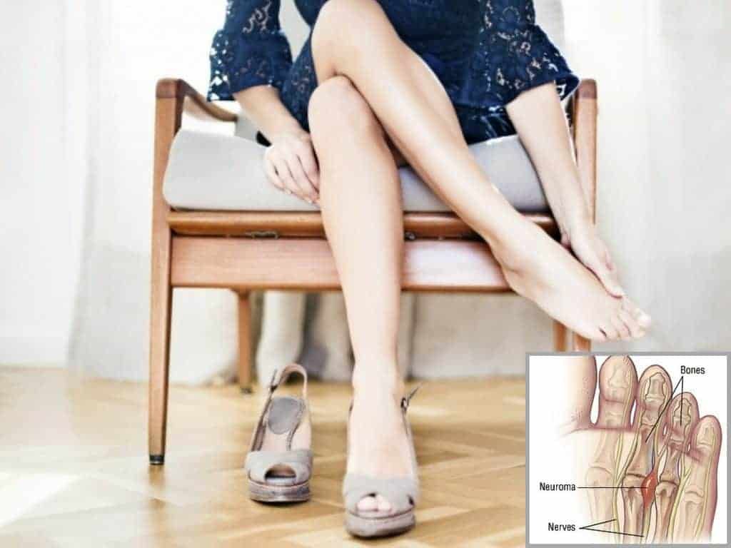 Morten’s neuroma Vs plantar plate - 2