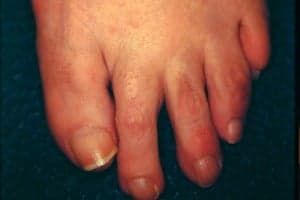 Standing on your feet for long periods at work - 2