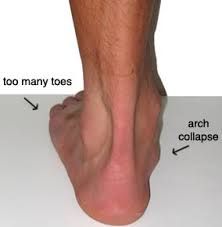 Standing on your feet for long periods at work - 4