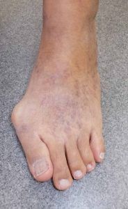 Standing on your feet for long periods at work - 5