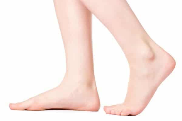 Taking care of common kids’ foot complaints - 3