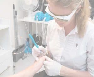 Top 4 reasons your Laser treatment for fungal nail infection won't or did not work - 1