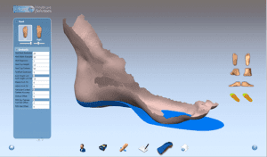 Why we make our own orthotics and how they are better - 1